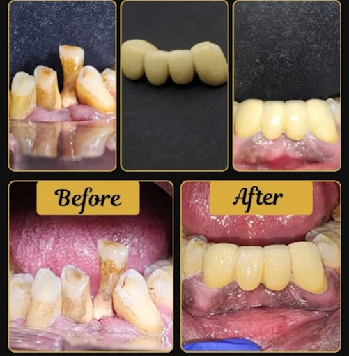Pooja Smile Care Dental Gallery Image 6